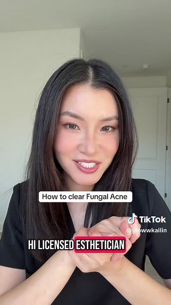 Skincare Routine for Fungal Acne: Tips & Treatments