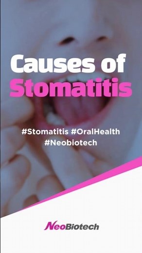 Causes of Stomatitis l Neobiotech