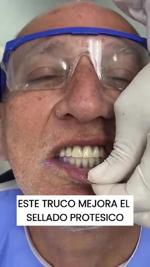 94K views · 716 reactions | 醴 Para optimizar el sellado en una...