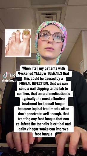 Effective Treatments for Toenail Fungus Explained