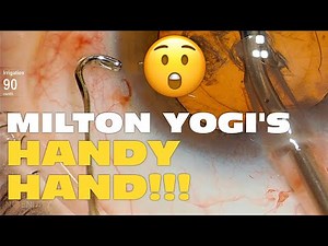 Phaco Clip #142 - Milton Yogi's "Handy Hand"
