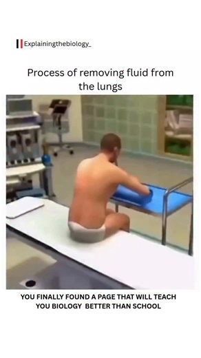 BIOLOGY | MEDICAL | LIFE | Pleural effusion is the abnormal accumulation of fluid in the pleural cavity, which is the thin space between the layers of pleura that... | Instagram