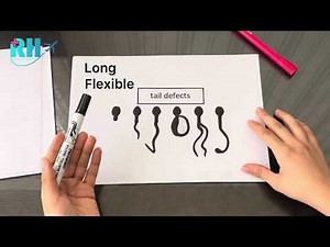 Everything about Sperm Morphology | Male Fertility | Sperm Defects