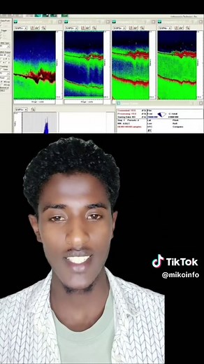#creatorsearchinsights #geologist #ethiopian_tik_tok #oromotiktok #oromotiktok❤️💚❤️ethiopiantiktok