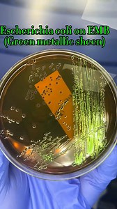 Some bacterial morphology on different media😍#lablife #microbiology #diagnosis | Lab life