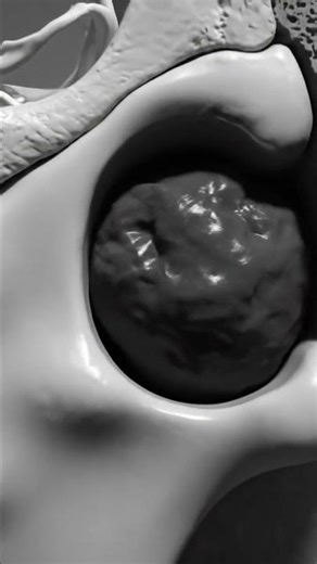 Bone Soft Tissue Mass