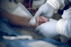 The incidence of Deep Vein Thrombosis (DVT) in patients with MIDLINE