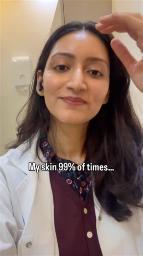 Why do pimples love showing up right before every major event?😢Learn how to fix it (in description)