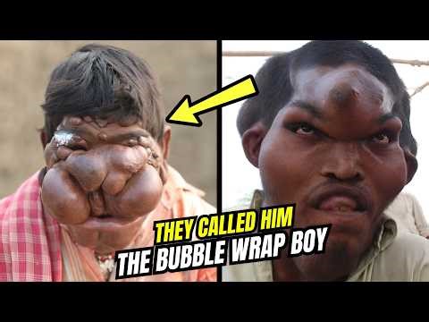 13 People With The Rarest Bodies Ever Recorded – 1 In A Billion Humans