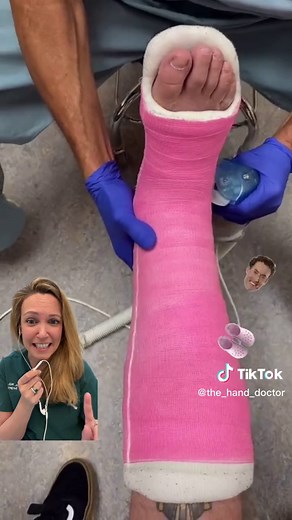 Pink Cast Removal and Orthopedic Surgery Experience