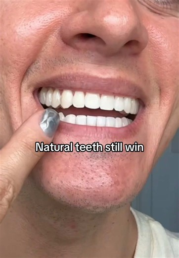 Natural teeth still win: real teeth care routine
