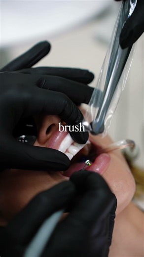 Watch to see what the best replacement for a missing tooth is 👀🦷#cosmeticdentist #floridadentist