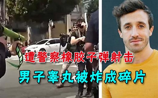 遭警察橡胶子弹射击，美国男子睾丸被炸成碎片，至今身心仍受创