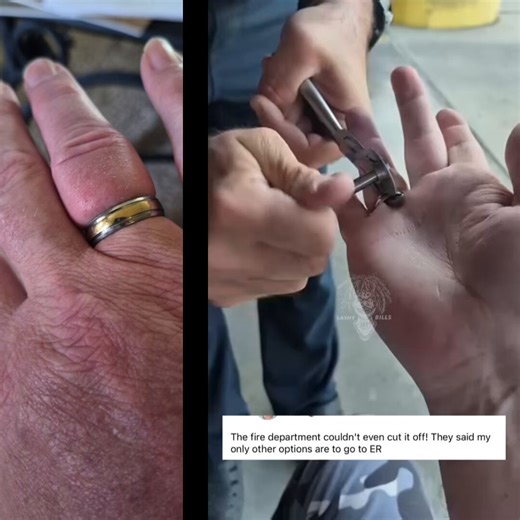 A man ended up in the ER after the fire department couldn't remove his wedding ring from his swollen finger.