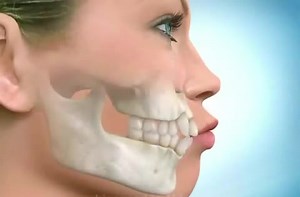 9.3K views · 198 reactions | How to fix Crowding #Dentistry #LearningTips #BitesnBraces | Bites & Braces Dental | Facebook