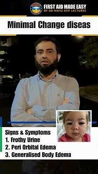 Minimal Change Disease | Nephrotic Syndrome | Dr.Hafiz Atif | First Aid Made Easy Platfrom