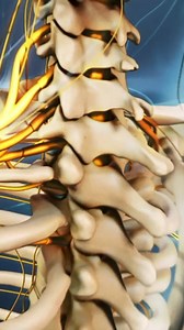 24K views · 226 reactions | Need relief from neck pain, herniated discs, or pinched nerves? In this video, we explain why a cervical epidural steroid injection is performed, how it works, and what to expect during the procedure. Whether you're dealing with chronic neck pain, radiating arm pain, or looking into alternatives to spine surgery, this quick guide breaks down everything you need to know about cervical epidurals. | Spine-health | Facebook