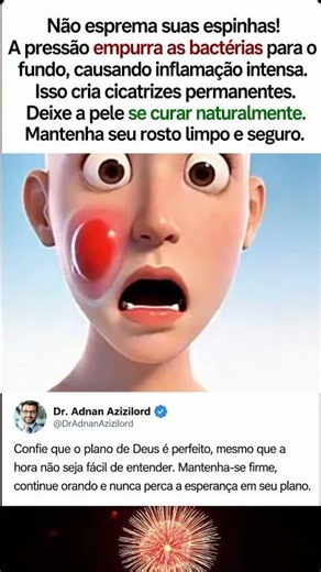 Nunca Esprema Espinhas! O Grande Erro Que Pode Danificar Sua Pele 😨