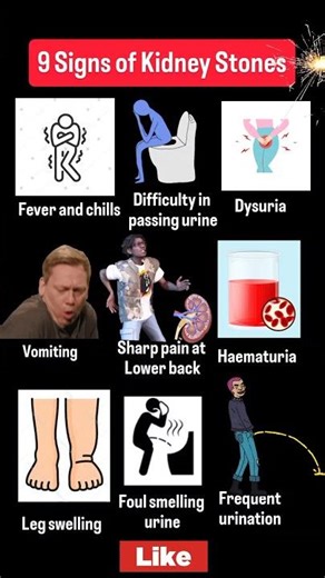 9 Signs of Kidney Stones You Shouldn’t Ignore | How to Know If You Have Kidney Stones