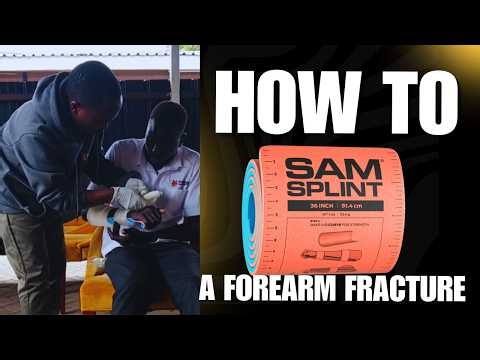 How to SAM Splint a Forearm Fracture | Step-by-Step.