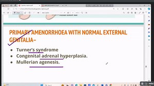 Topic : Pathology 2 Review Class Mentor: Dr. Mahdi Sattar Khan Riza FCPS Part 1 (Surgery) BCS (Health) MS Resident Otolaryngology, BSMMU | Exclusive Education Aid