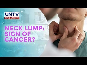 Bukol sa leeg, senyales nga ba ng cancer o matinding karamdaman?