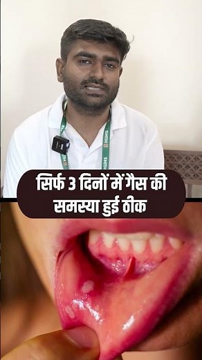 Home Remedy for Gas & Acidity | Boost Liver Health Naturally | Acharya Manish Ji