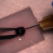 Video: Isolation of Primary Mouse Retinal Pigmented Epithelium Cells