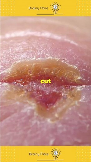 The Human Integumentary System in 60 Seconds