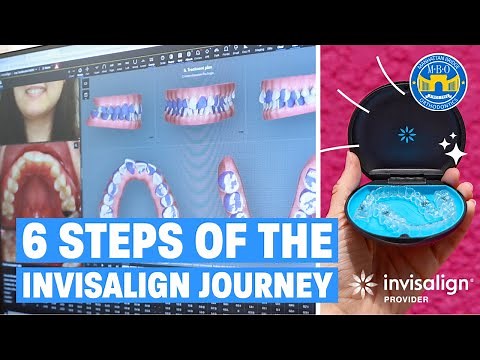 Process of Starting Invisalign Journey