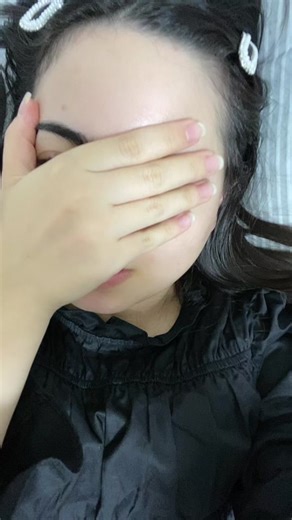 霰粒腫手術後のケアと注意点