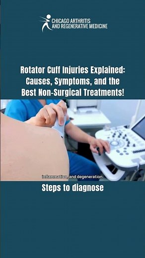Steps to diagnose | Rotator Cuff Injuries Causes, Symptoms, and the Best Non-Surgical Treatments