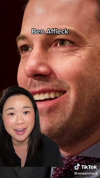 Ben Affleck Veneers Transformation Exposed!