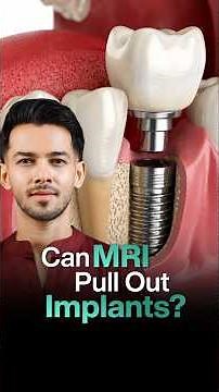 Can You Get an MRI with Dental Implants? | MRI Safety, Titanium Implants & Airport Detector Myths