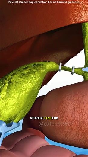 Gallbladder Removal Surgery 3D Animation (Cholecystectomy) #cholecystectomy #cholecystitis #cholecystectomyrecovery #cholecystectomy# #cholecystectomyproblems #cholecystitis? #gallbladderremoval #gallbladderremovalsurgery #laparoscopicsurgery #laparoscopiccholecystectomy #medical3danimation #3dmedicalanimation
