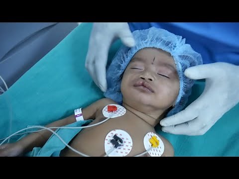 Intubation Procedure for a Pediatric Child by Expert Anesthesia Doctors at Richardsons