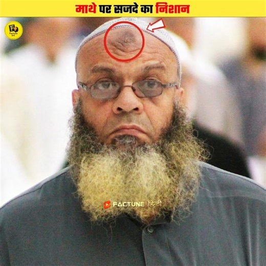 What Does A Forehead Sajda Mark Signify? #shorts