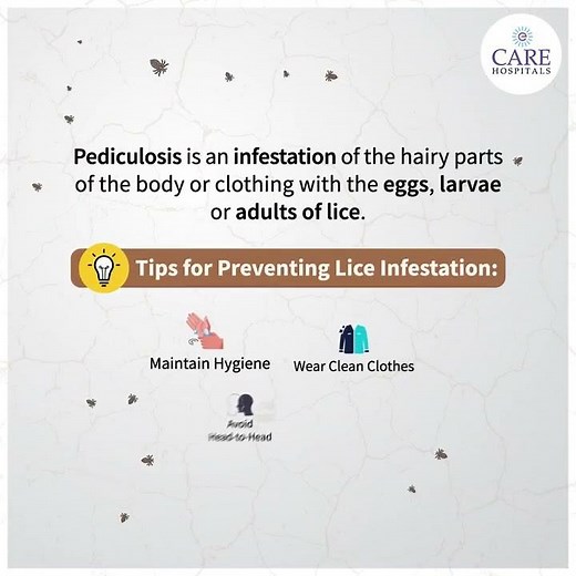 What is Pediculosis | Pediculosis Awareness Month | CARE Hospitals