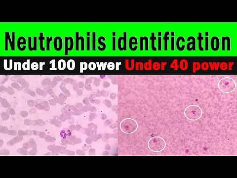How to identify Neutrophils in microscope | white blood cell identification | Neutrophils