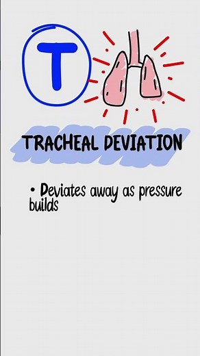 Pneumothorax Mnemonic P-THORAX | USMLE Step 1 High-Yield Lung Collapse