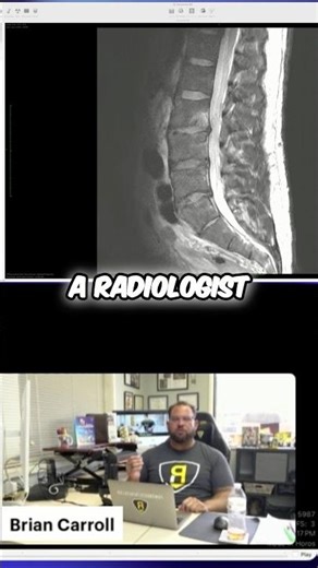 Breaking down low back pain clients MRIs! #casestudy #mri #lowerbackpain #backpainrelief #football
