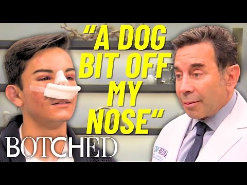 Dr. Nassif Transforms Dog Attack Survivor's Nose With Amazing Results | Botched | E!