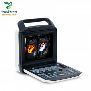 [Hot Item] Ysenmed Médical Ysb-M5 Appareil d'échographie Doppler couleur portable Équipement médical