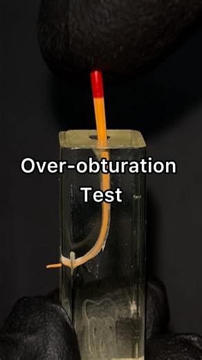 Dentistry hands on | ‼️ Prevent over-obturation with a simple test! This test is especially helpful in multi-rooted teeth that have multiple reference points. .... | Instagram