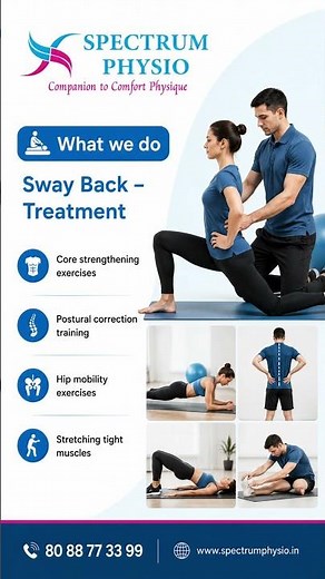 Sway Back Posture: Signs, Symptoms, Causes & Treatment | How to Fix Poor Posture