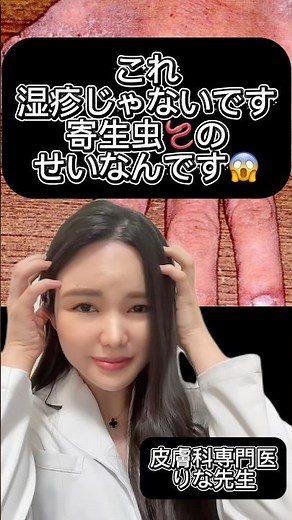 #疥癬#ニキビ #ニキビ #美容 #湿疹 #スキンケア #乾燥ケア #美肌