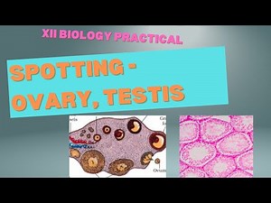 Spotting- T.S. Testis, Ovary/ XII Biology Practical
