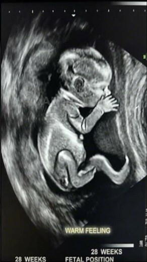 28 Weeks Pregnant Ultrasound | Baby Growth & Development in Womb