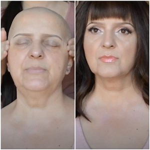 Applying makeup on Chemo patient - the before and after! | MetDaan Creative