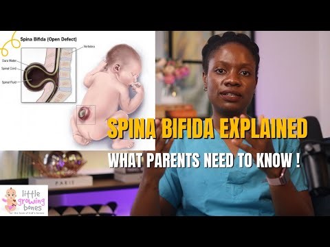 My Child Has Spina Bifida – What Does It Really Mean?